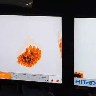 Traffico di eroina a Malpensa, sequestro per 1 milione e 7 arresti