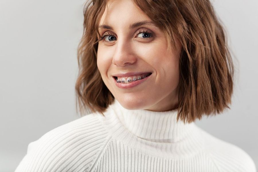 Italiani e sorriso, sempre più adulti con l’apparecchio ortodontico Italiani e sorriso, sempre più adulti con l’apparecchio ortodontico