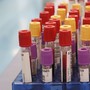 Botulino, dal 2001 al 2024 segnalati 1.276 casi in Italia